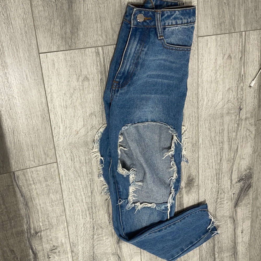 Big cuts on both legs